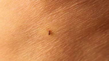 Makro inatçı pire insan derisini ısırıyor ve kan emiyor. Bir parmak ittiğinde ayrılmayı reddediyor. Hayvansal hastalıklar, pire kaynaklı enfeksiyonlar, parazitoloji, dermatoloji ve sağlık için güçlü bir görüş..