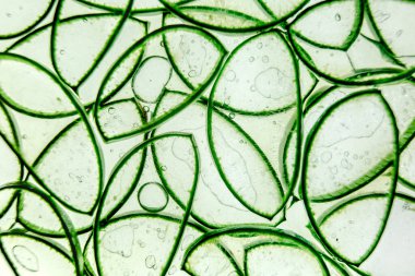 Aloe vera dilimleme dokusu arka planı. İlaç fabrikası. Tedavi etmek ve krem yapmak için kullanılır. Düz yatıyordu. Üst görünüm.