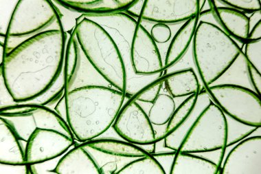 Aloe vera dilimleme dokusu arka planı. İlaç fabrikası. Tedavi etmek ve krem yapmak için kullanılır. Düz yatıyordu. Üst görünüm.