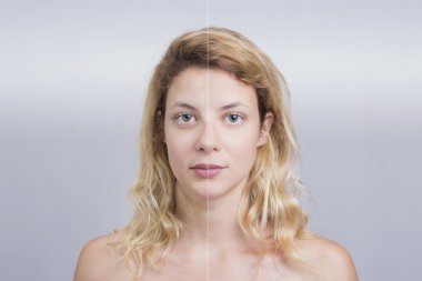 Cilt işlemden önce ve sonra