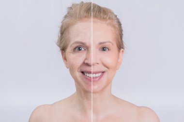 Before and after sking treatment clipart