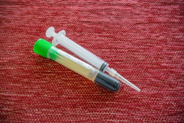 Jeringa, aguja y tubo sanguíneo — Foto de Stock