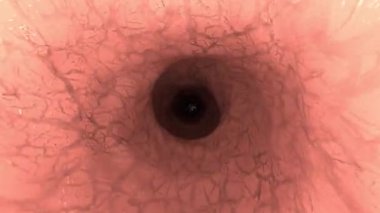 Endoskop tıbbi kamera bağırsak bağırsağı doktor endoskopi ameliyatı 4k