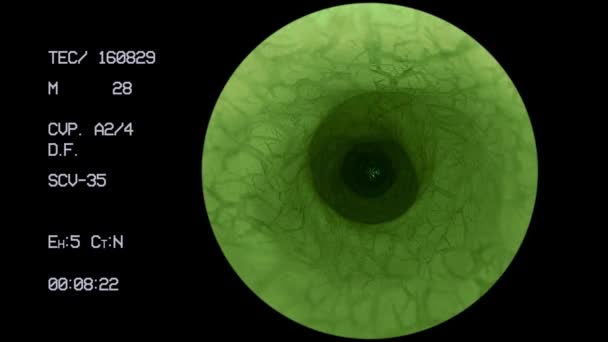 Endoscópio Alienígena Coragem Halloween Ciência Paranormal Criatura Sonda Anal Ufo — Vídeo de Stock