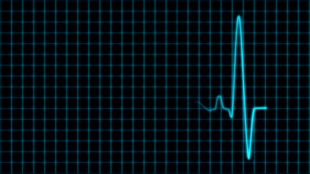 Elektrokardiogram cardiograph oscilloskop skärm med rutnät blå slinga — Stockvideo