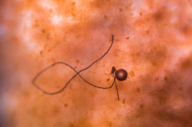 bakterilerin mikroskop altında