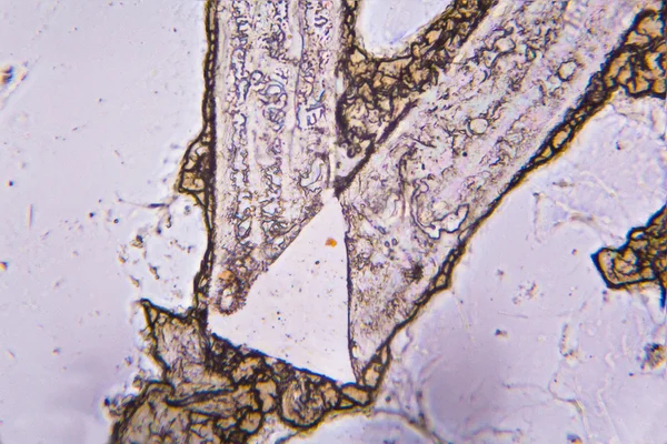 Зажатые клетки крови под микроскопом — стоковое фото