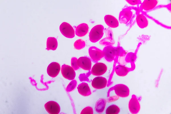 Citrina hemerocus зреет под микроскопом - Abstra — стоковое фото