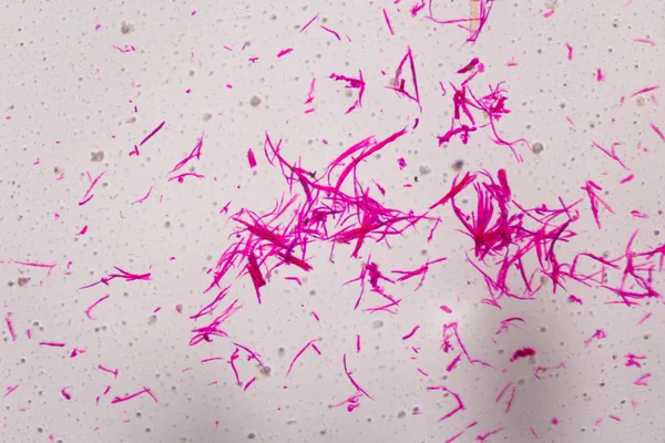 Гладкая мышца отделяется под микроскопом - Абстрактная розовая линия — стоковое фото