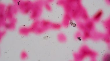 Mikroskop - beyaz arka plan üzerinde soyut pembe nokta altında birden fazla Skuamöz epitel
