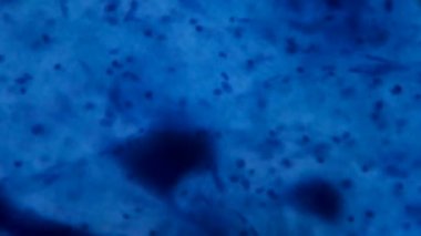 Sinir hücresi mikroskop - beyaz arka plan üzerinde soyut mavi noktalar altında