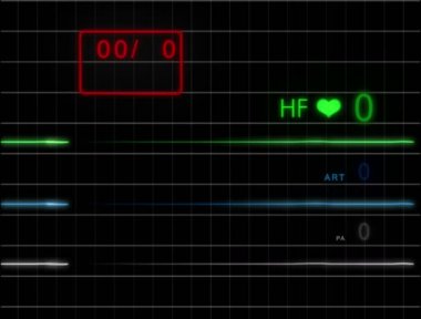 E.C.G monitör - Pulse - kılavuz - 4k ile olmadan