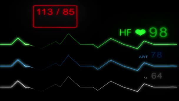 Monitoraggio elettrocardiogramma - con impulso - senza griglia - HD — Video Stock