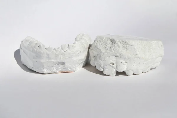 Modelo de gesso dentário moldado mandíbulas humanas estomatológicas — Fotografia de Stock