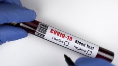 Mikrobiyologların ellerinin üzerinde mavi ameliyat eldivenleri var. Kan toplama tüpü var. Test sonuçları COVID-19 olduğunu gösteriyor.