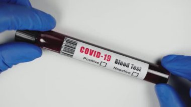Mikrobiyologların ellerinin üzerinde mavi ameliyat eldivenleri var. Kan toplama tüpü var. Test sonuçları COVID-19 negatif.