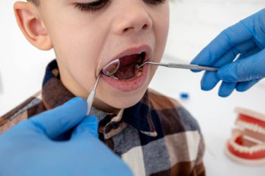 Bir dişçi, bir çocuğun diş boşluklarını ayna ve sonda kullanarak inceler. Diş çürüğü..