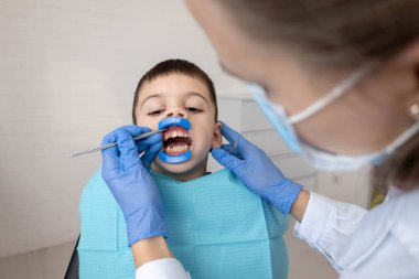 Ağız retraktörüyle çocuk diş kontrolü. Pediatrik dişçilik kavramı.