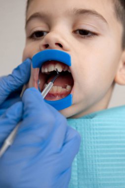 Ağız retraktörüyle çocuk diş kontrolü. Pediatrik dişçilik kavramı.