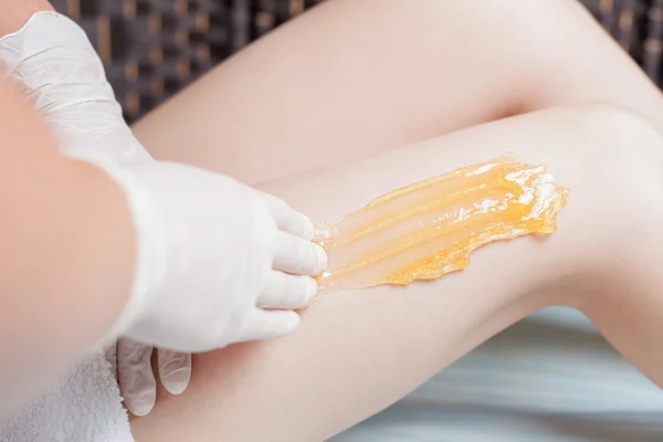 Sugaring epilation skin care with liquid sugar at legs — Stock Photo, Image