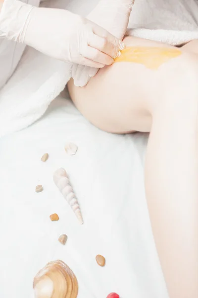 Sugaring epilation skin care with liquid sugar at legs — Stock Photo, Image
