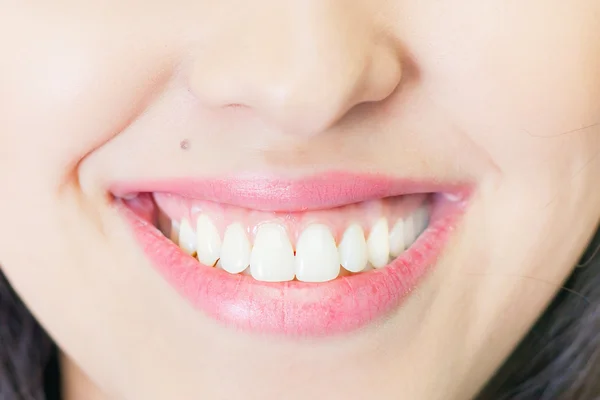 Красива жінка посміхається зі здоровим відбілюванням зубів — стокове фото