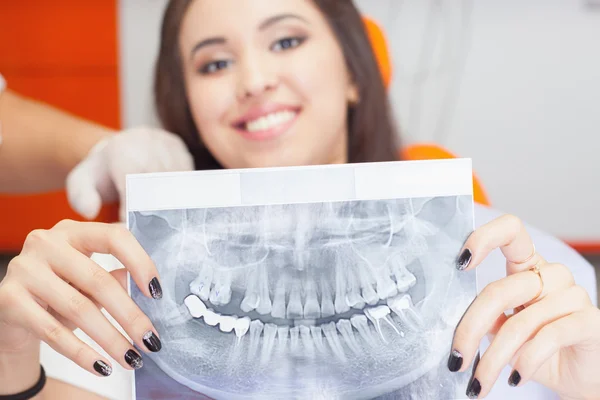 Pacjenta piękna dziewczyna trzyma zdjęcie rentgenowskie jej zębów — Zdjęcie stockowe