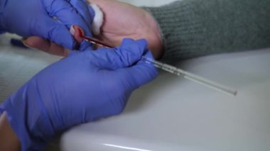 Doktor hasta parmağından kan örneği alır..