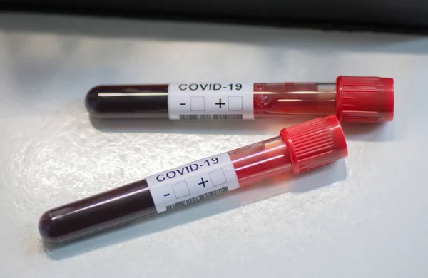 Two disposable test tubes for covid-19 test — Stock Photo, Image