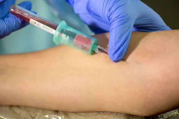 Klinikteki laboratuvar. Kadın laboratuvar asistanı test için venöz kan alıyor..