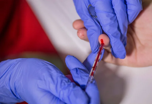 Doktor hasta parmağından kan örneği alır..