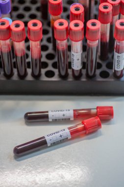 Tek kullanımlık tüpler, kovid 19 testi için venöz kan.