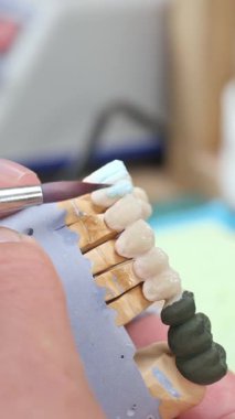 Doktor ortodontist el, diş hekimliği laboratuarında diş minesi ve çene alçıtaşı modeliyle seramik taçları kaplar. Teknisyen, gerçekçi dikey video kullanarak diş protezi üzerinde çalışıyor.