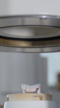 Diş implantlarını stomatoloji kliniğindeki kurutma makinesine yerleştiriyorum. Laboratuvar dikey videosunda yüksek sıcaklık işleme sırasında modern diş köprüsünün dayanıklılığının artırılması
