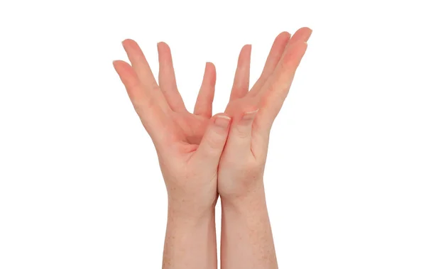 Sommersprossige Weiße Hände Die Absätze Der Hände Zusammen Die Finger — Stockfoto