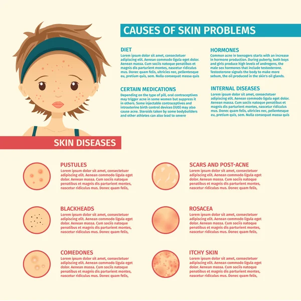 Infographics of skin problems, the causes of problem skin, types of problems. Girl with acne, pores, scars, pustules. — Vettoriale Stock
