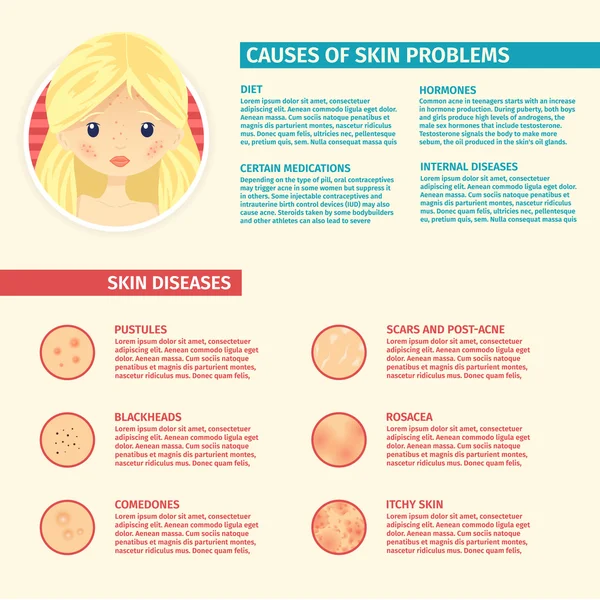 Infographics of skin problems — Stockový vektor