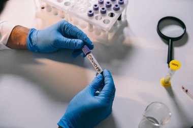 Doktor 2019 nCoV analizi için test tüpünü kanla tutuyor. Coronavirus hastalığı COVID-19 salgını. Sağlık sigortası konsepti, virüs testi. Nüfusun covid 19 'a bağışıklığı var mı diye kontrol ediliyor
