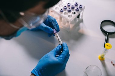 Hekimler üzerinde Coronavirus COVID-19 yazan ve üzerinde kan olan test tüpünü tutuyorlar. 2019-nCoV Coronavirus. Doktorların elinde eldivenli kan örneği bulundu. Reseach laboratuvarında analiz ediliyor