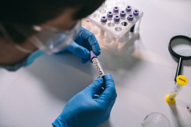 Doktor 2019 nCoV analizi için test tüpünü kanla tutuyor. Coronavirus hastalığı COVID-19 salgını. Sağlık sigortası konsepti, virüs testi. Nüfusun covid 19 'a bağışıklığı var mı diye kontrol ediliyor
