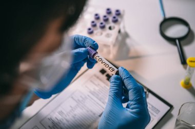 Doktor Coronavirus 2019 nCoV kan örneğini tutuyor. Aşı kavramı, Covid 19 tanı. Teşhis ve laboratuvar. Pozitif koronavirüs testi yapan bir bilim adamı. Virüs bulaşmış. Salgın