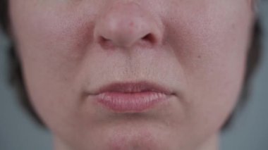 Cipsten sonra tema yenileme dişleri, travma ve hasar. Ön dişi reçine iğnesiyle ikiye ayrılmış gülümseyen bir kadın. Fiberglas raptiyeli dişlerin restorasyonu. Protez dişçilik kavramı