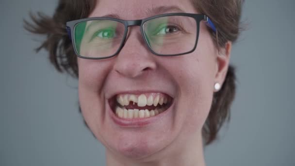 Χαμογελαστή νεαρή καυκάσια γυναίκα με σπασμένο μπροστινό δόντι από το οποίο προεξέχουν καρφίτσες από υαλοβάμβακα. Τραύμα δοντιών, σπασμένο δόντι μετά το ατύχημα. Οδοντιατρική και γναθοπροσωπική θεραπεία. Οδοντιατρικό τραύμα — Αρχείο Βίντεο