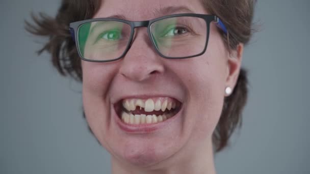 Mulher branca jovem sorridente com dente dianteiro quebrado do qual os pinos de fibra de vidro se salientam. Lesão dentária, dente lascado, metade após acidente. Odontologia e tratamento maxilofacial. Trauma dentário — Vídeo de Stock