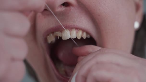 Famale avec de mauvaises dents a changé d'avis tard et utilise de la soie dentaire, mais trop tard ses dents sont endommagées. Femme avec une dent avant endommagée rend l'hygiène buccodentaire sur fond gris. Soins de santé — Video