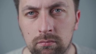 Stüdyoda anormal diş pozisyonu, beyaz adam, ortodontik konsept. Diş sağlığı, erkek diş problemi. Çakışan dişler, kalabalık diş, çürük diş. Ortodontist tarafından tedaviden önce dişler
