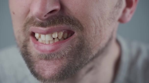 白人年轻男性中的闭塞，上牙拥挤。丑陋的牙齿和可怕的笑容。假牙男子的特写。牙齿问题，护理，牙痛。安装牙套的理由 — 图库视频影像