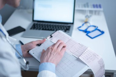 Kalp hastalıklarına zamanında bakmanın konusu. Kalp hastalığı miyokardiyal enfarktüs. Hastane ofisindeki masada elektrokardiyogramı analiz eden doktor. Klinikte kardiyolog. Doktor EKG 'ye bak..