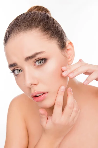 Ritratto di giovane donna attraente in cerca di acne sul suo viso — Foto Stock