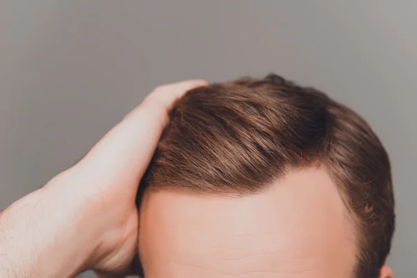 Close up foto de limpar o cabelo do homem saudável sem pelo — Fotografia de Stock
